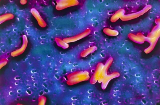 बागबजारको धारा र ट्युवबेलको पानीमा भेटियो हैजा फैलाउने जिवाणु