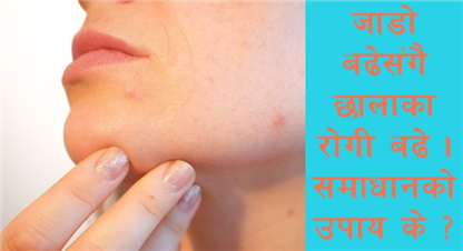 चिसो बढेसँगै छालामा सङ्क्रमणको खतरा, चिसोबाट छालालाई बसरी बचाउने ? 